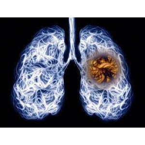 Điều trị COPD kèm di chứng do lao